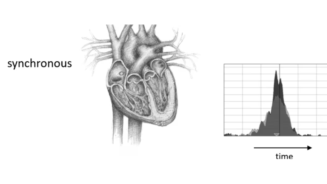 Preview of synchronous UHF-ECG activation video