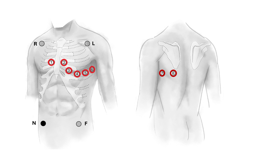 UHF-ECG 12(14)-lead chest electrode positions