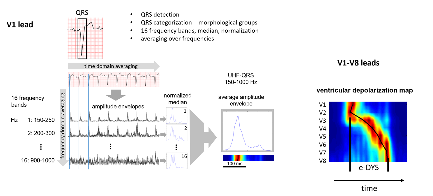 UHF-ECG real-time signal processing method