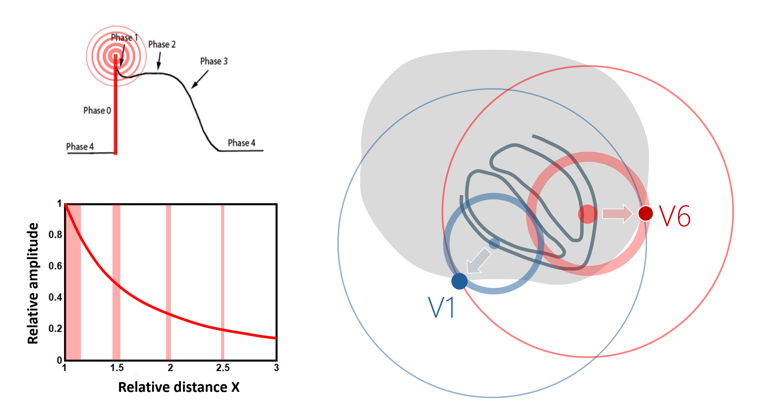 UHF-ECG principle of localized ultra-high-frequency signal detection