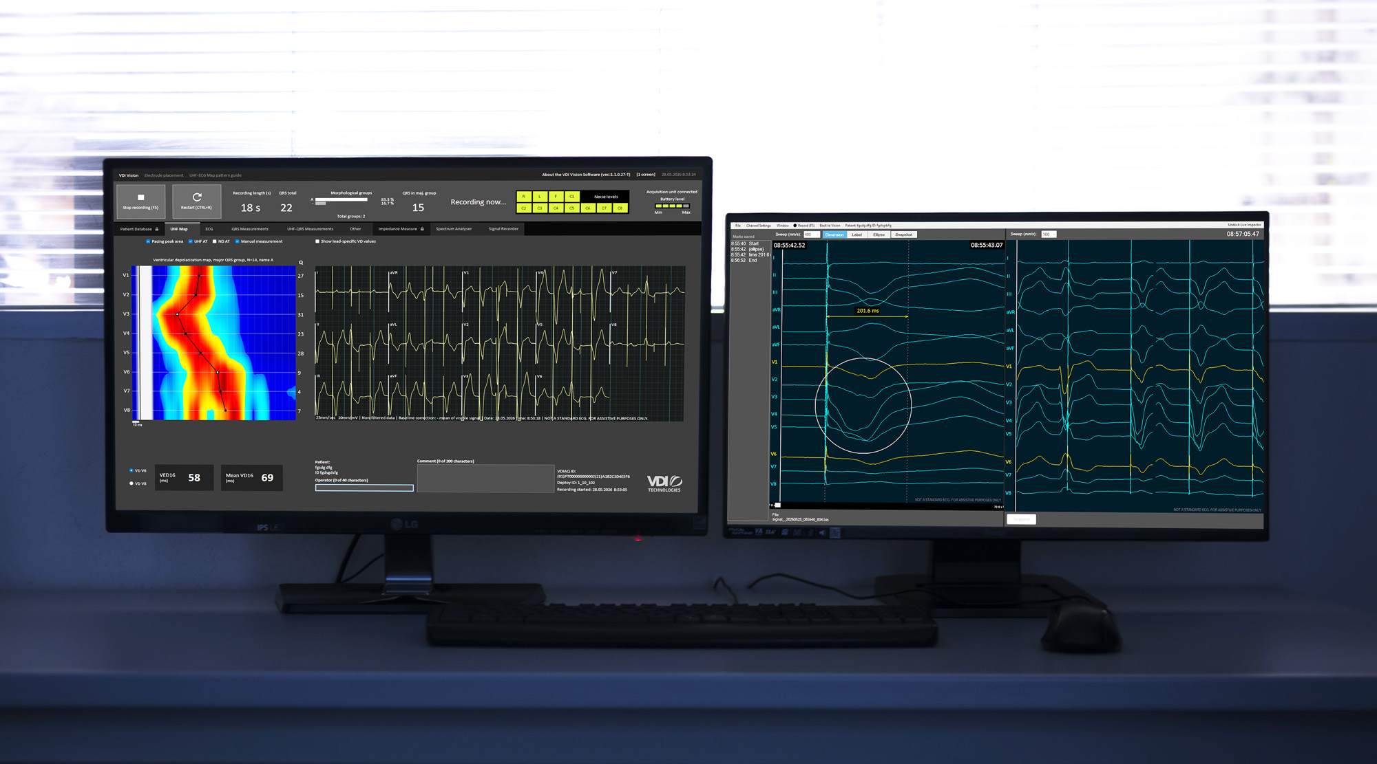 VDI Signal Recorder multi-screen ECG waveform monitoring tool